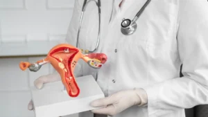 Colposcopy